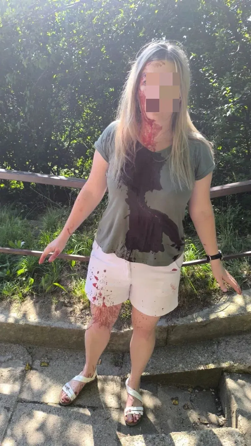 Dwukrotnie uderzył kobietę laską w głowę