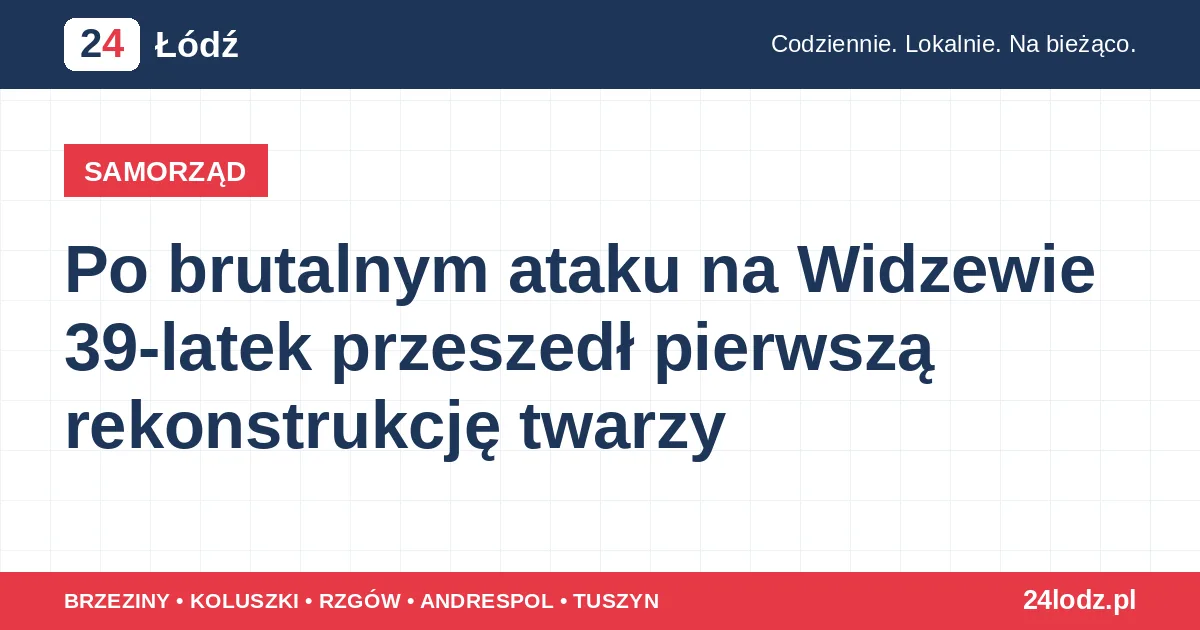 Po brutalnym ataku na Widzewie 39-latek przeszedł pierwszą rekonstrukcję twarzy