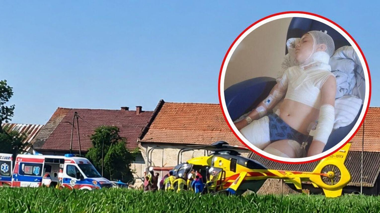 Prokuratura wszczęła śledztwo po dramatycznym pogryzieniu 9-latka przez psy w Maciowakrzu