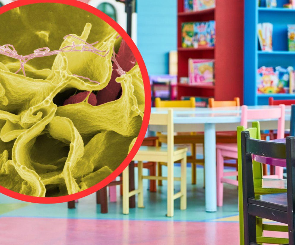 Salmonella w żłobkach i przedszkolach w powiecie rzeszowskim. Już u 133 dzieci wystąpiły objawy
