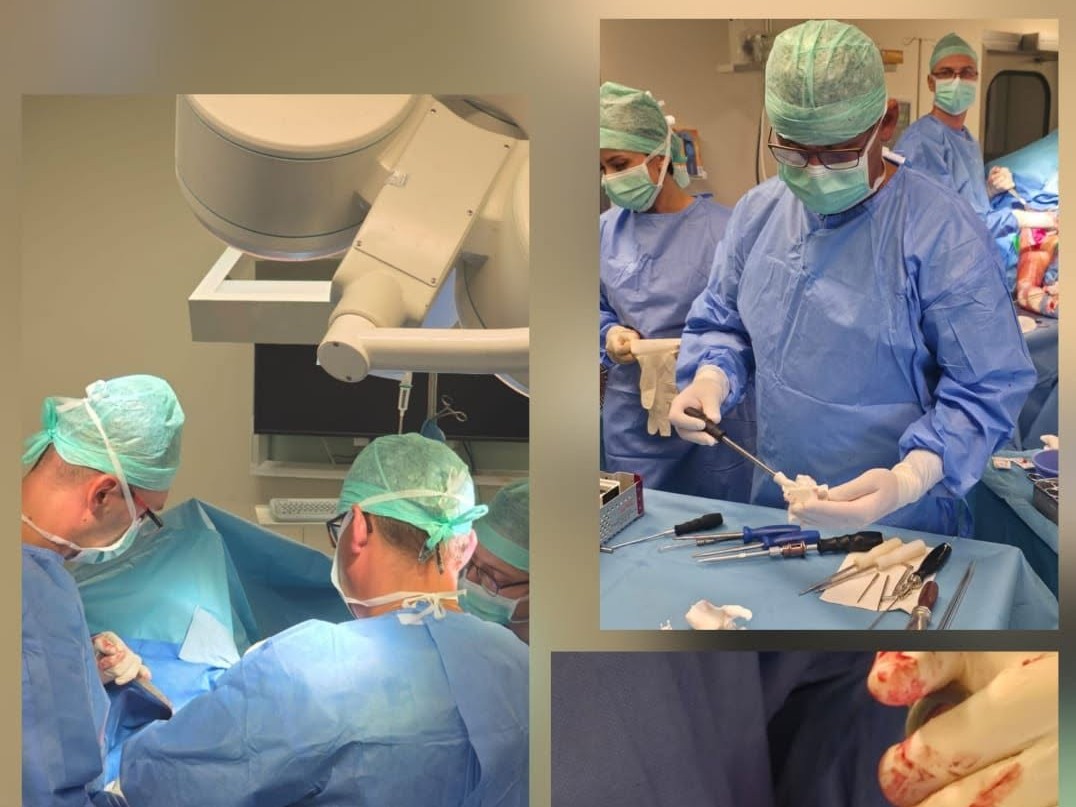 Szpital w Rybniku chwali się nowatorskim zabiegiem. Pacjentce wszczepiono protezę „szytą na miarę”